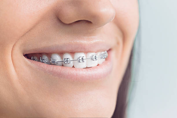Best Full Mouth Reconstruction  in Fort Hood, TX
